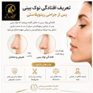 افتادگی نوک بینی