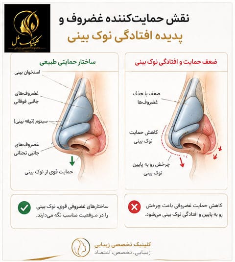 002 نقش حمایتکننده غضروف و پدیده افتادگی نوک بینی