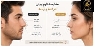 بینی مردانه و زنانه