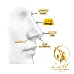 پل بینی چیست | انواع پل بینی