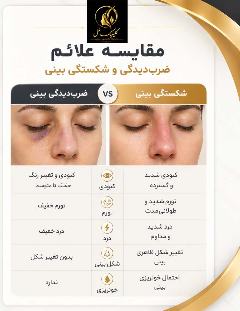 شکستگی بینی