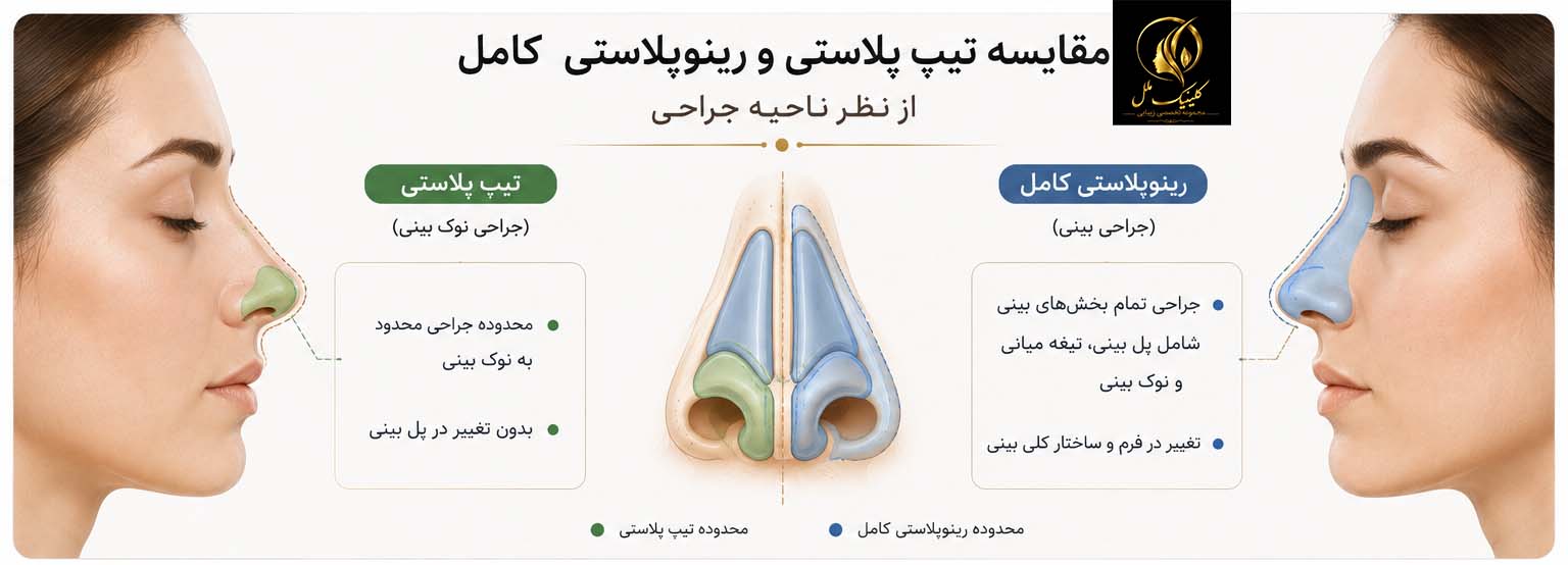 f2 مقایسه تیپ پلاستی و رینوپلاستی کامل از نظر ناحیه جراحی