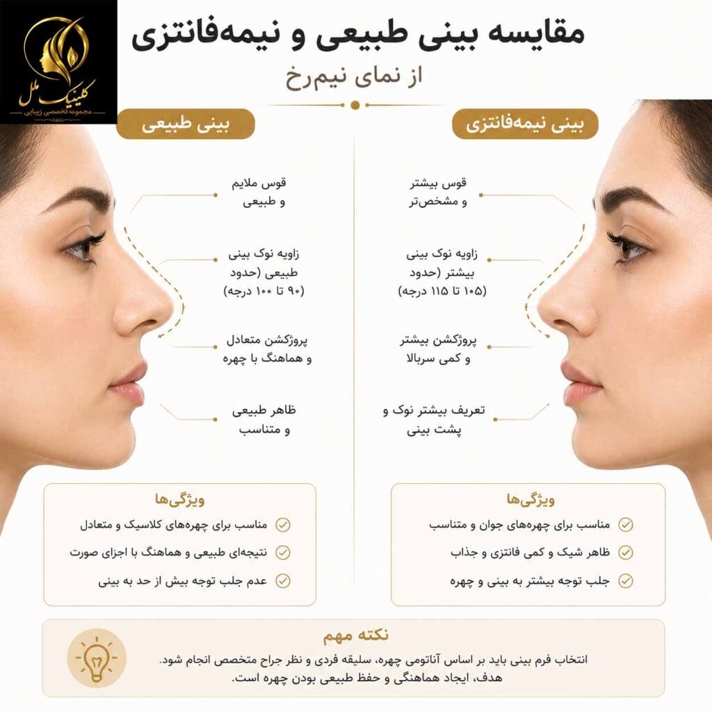 بینی طبیعی و نیمه&zwnj; فانتزی