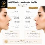 مقایسه بینی طبیعی و نیمه فانتزی از نمای نیم رخ