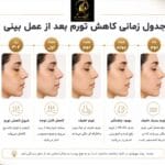 عوارض بعد عمل بینی