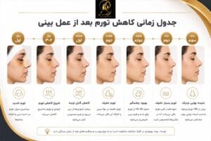 عوارض بعد عمل بینی