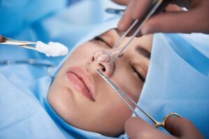 نکات کلیدی بعد از جراحی بینی