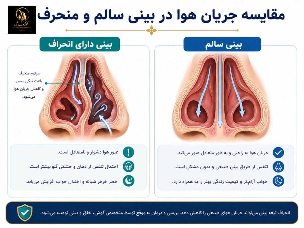 002 انحراف تیغه بینی