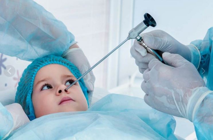 جراحی انحراف بینی در کودکان