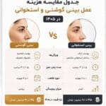هزینه عمل بینی