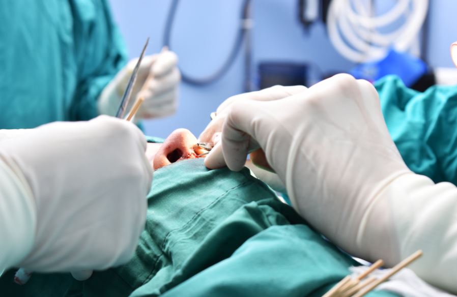 جراحی بینی کوچک | جراحی بینی افزایشی