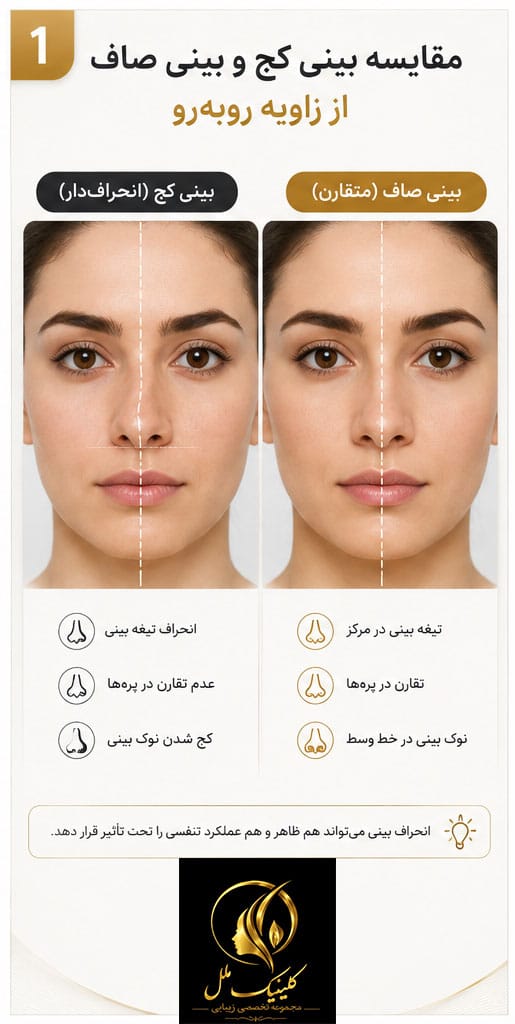 مقایسه بینی کج و بینی صاف از زاویه روبه&zwnj;رو