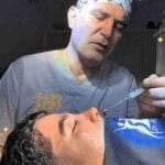 دکتر بابک حاجی&zwnj; براتی در اتاق عمل بلافاصله بعد از عمل بینی