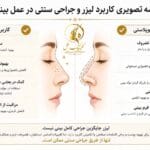 عمل بینی با لیزر