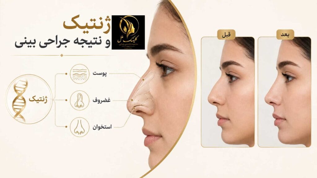 r03 تاثیر ژنتیک در نتیجه جراحی بینی