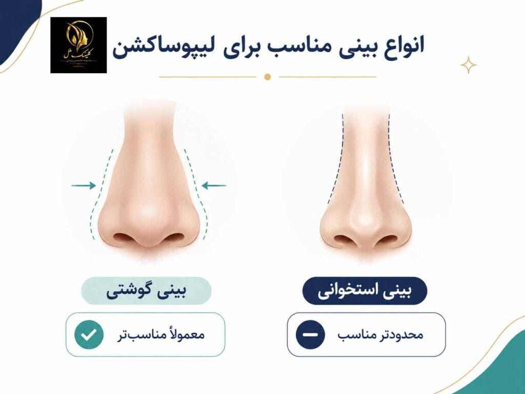 انواع بینی برای لیپوپلاستی