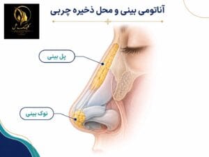 لیپوساکشن بینی