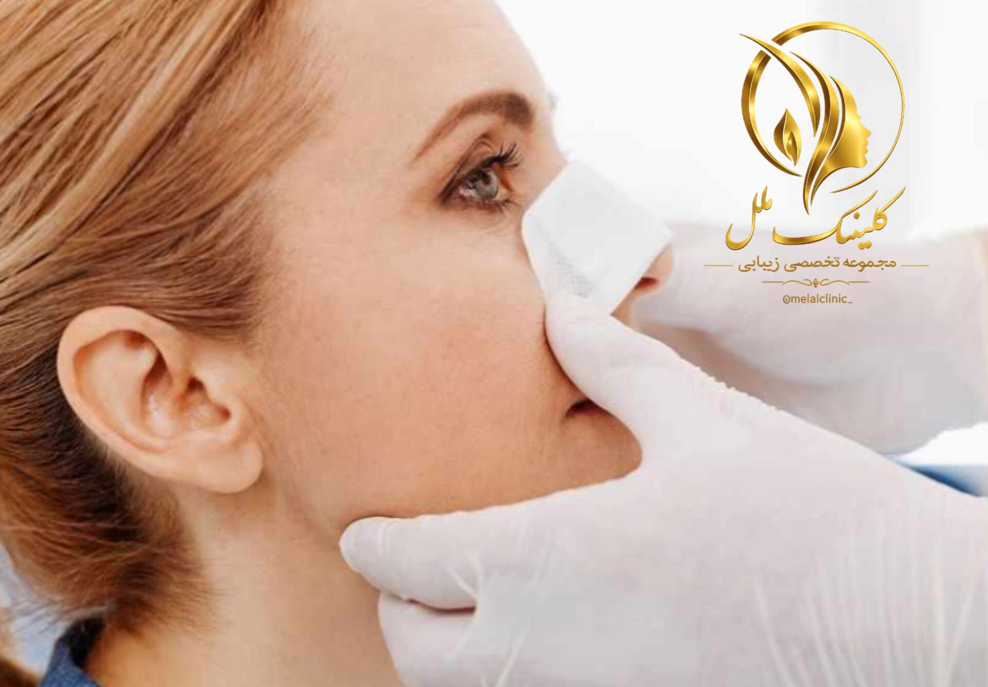 عمل بینی (رینوپلاستی) | راهنمای جامع از تشخیص تا بهبودی جراحی بینی