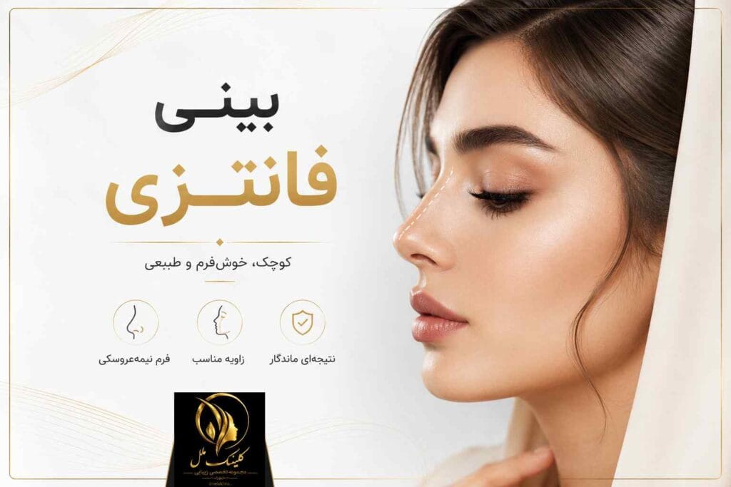 بینی فانتزی