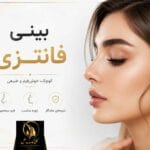 بینی فانتزی