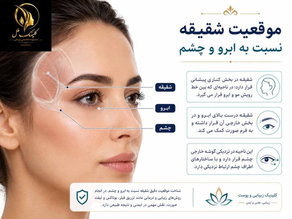 جراحی لیفت شقیقه