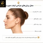 لیفت صورت