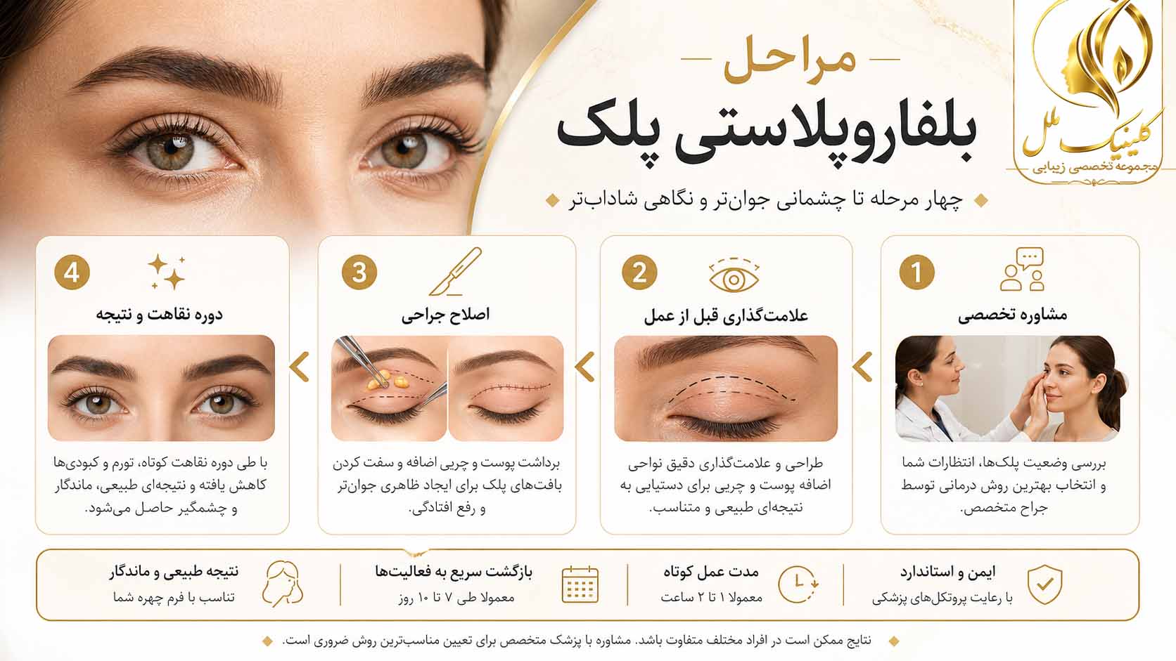 بلفاروپلاستی