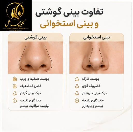 تفاوت بینی گوشتی و بینی استخوانی