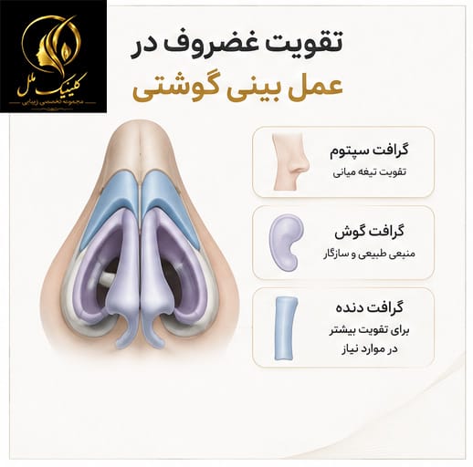 تقویت غضروف در عمل بینی گوشتی