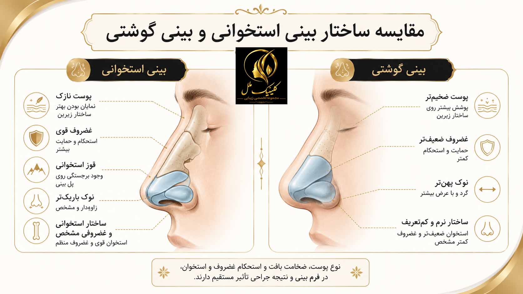 عمل بینی استخوانی چیست؟ هزینه، مراحل و نتیجه جراحی عمل بینی استخوانی