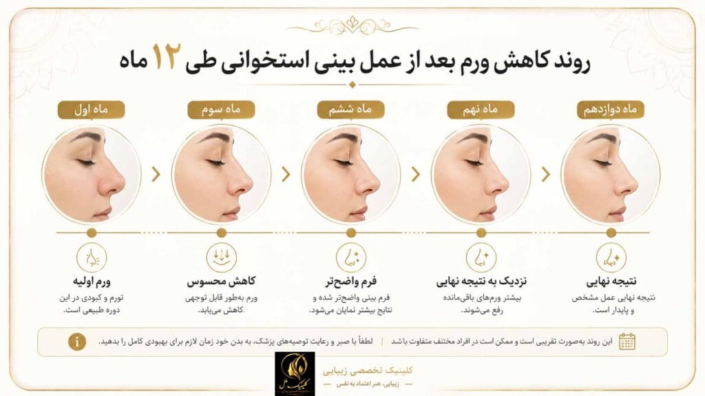 bone-nose2 روند کاهش ورم بعد از عمل بینی استخوانی طی ۱۲ ماه