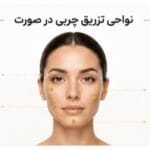 تزریق چربی به صورت