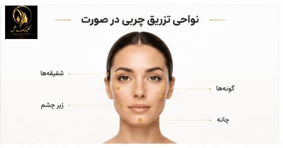 ChatGPT Image Aug 18, 2026, 02_31_18 PM - Copy (5) تزریق چربی به صورت