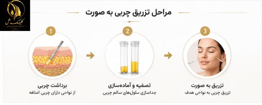 ChatGPT Image Aug 18, 2026, 02_31_18 PM - Copy (2) مراحل تزریق چربی زیبایی صورت