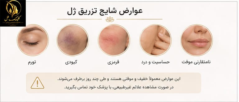 filler-side-effects عوارض شایع تزریق ژل