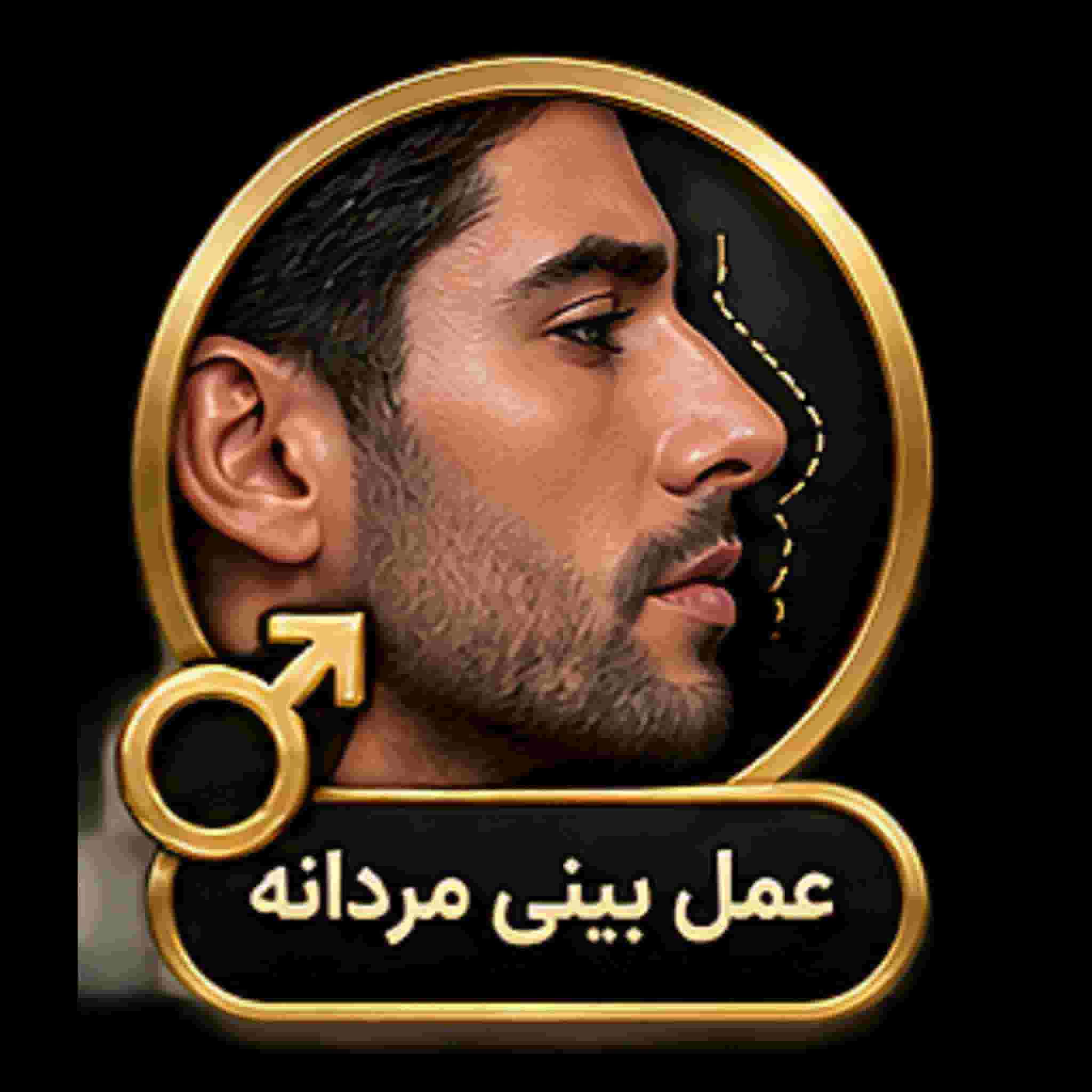 male rhinoplasty