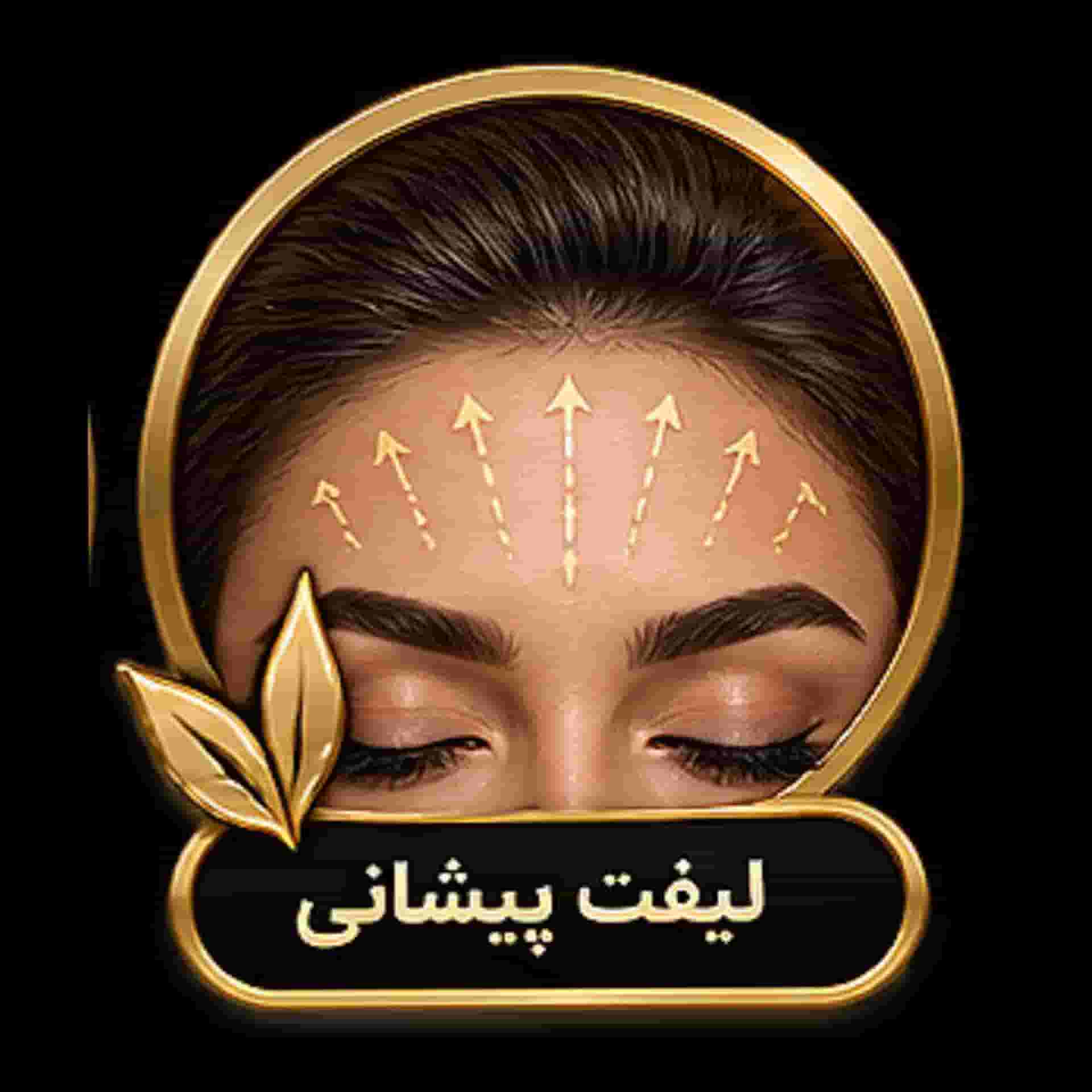 forehead reduction