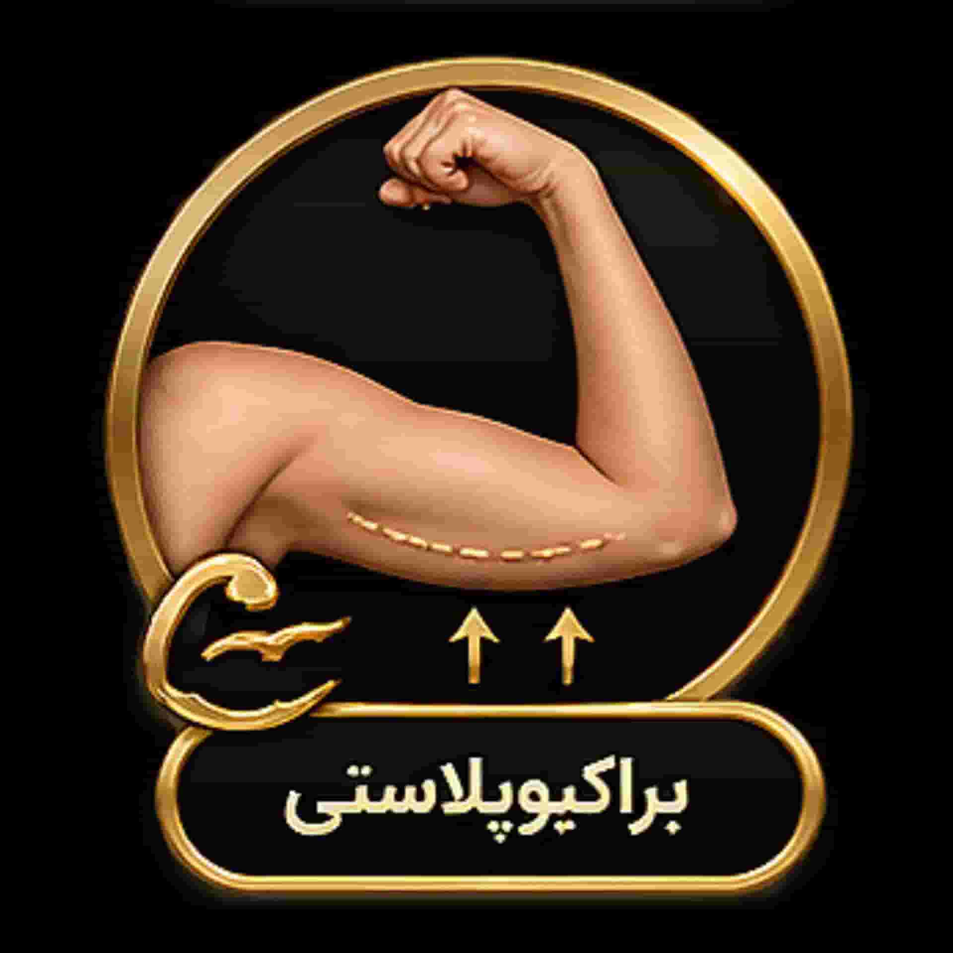 brachioplasty