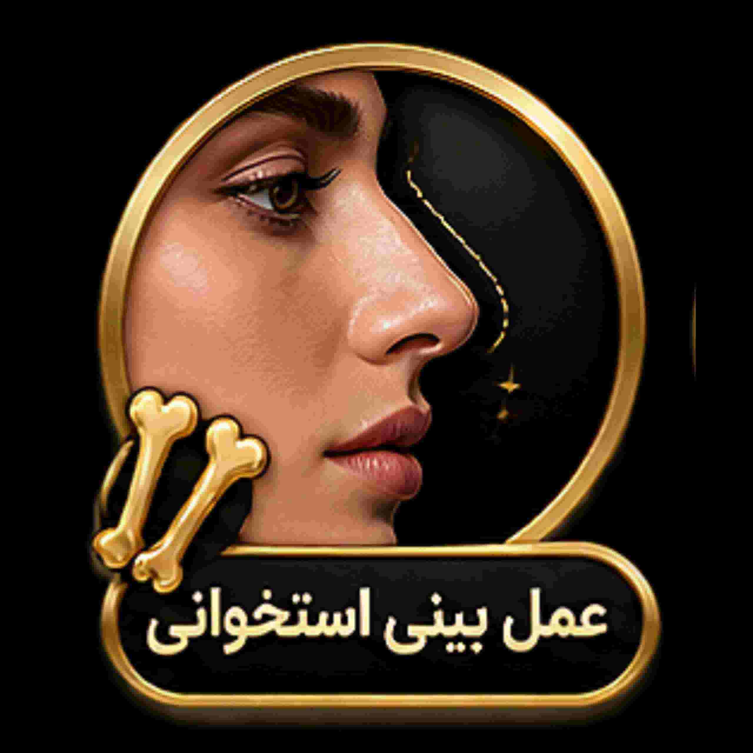 bony nose rhinoplasty