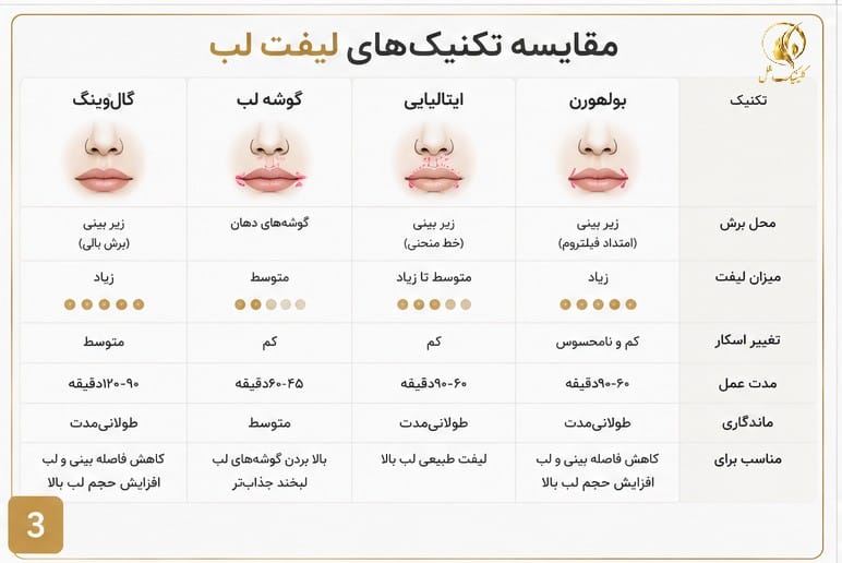 مقایسه تکنیک&zwnj;های بولهورن، ایتالیایی، گوشه لب و گال&zwnj;وینگ