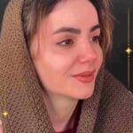 نمونه جراحی بینی
