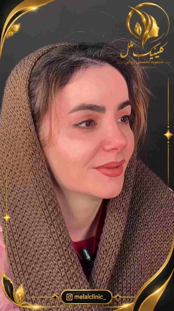 نمونه جراحی بینی