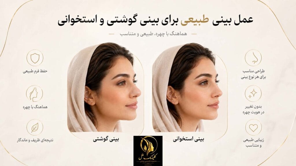 عمل بینی طبیعی برای بینی گوشتی و استخوانی