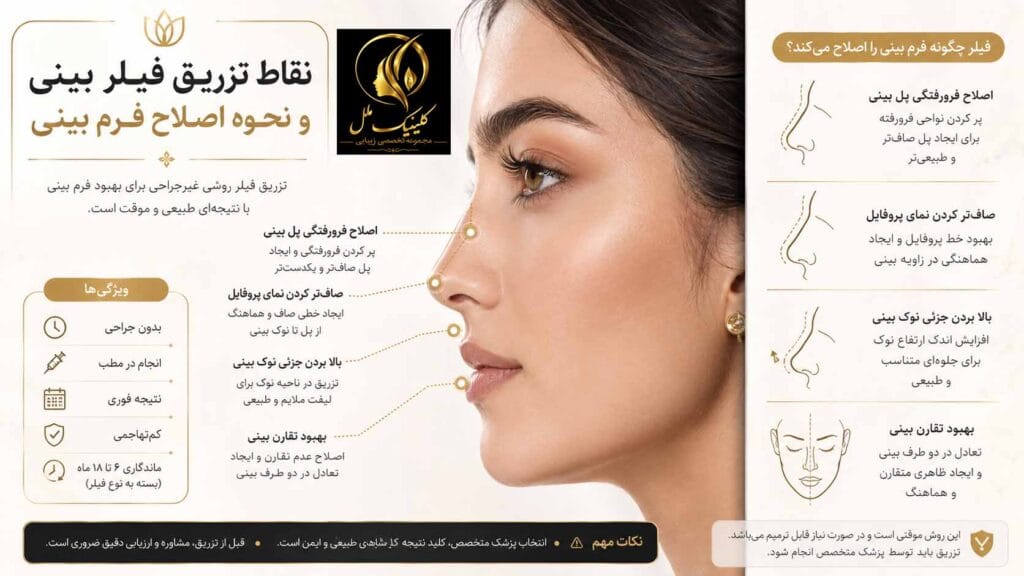 نمودار نقاط تزریق فیلر بینی