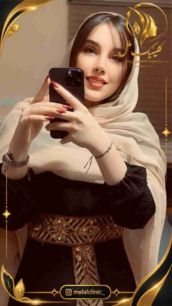 بعد از رینوپلاستی طبیعی &ndash; نمای روبه&zwnj;رو، حفظ ظاهر طبیعی بینی