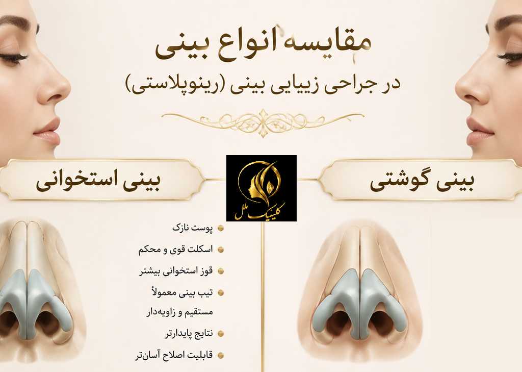 مقایسه ویژگی&zwnj;های بینی استخوانی و بینی گوشتی در جراحی بینی