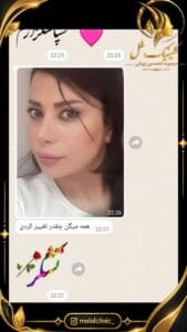 رضایت از تیپ پلاستی