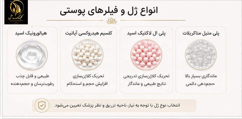 types-of-fillers انواع ژل و فیلرهای پوستی