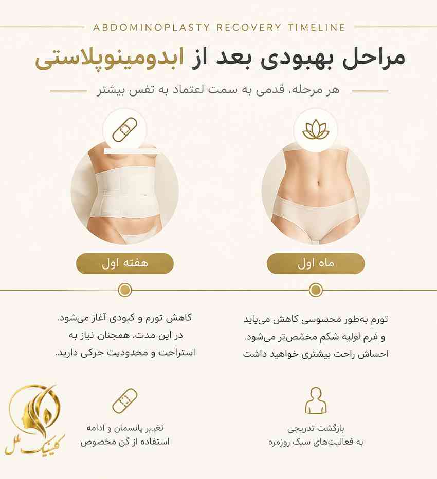 جدول زمانی دوره نقاهت ابدومینوپلاستی از روز اول تا ماه&zwnj;های بعد