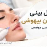 عمل بینی بدون بیهوشی با بی&zwnj;حسی موضعی